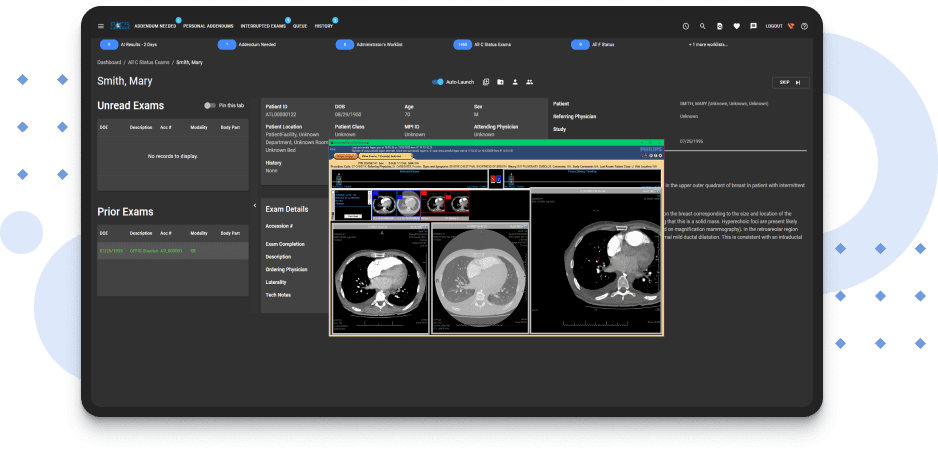 Development of a Tool for Managing Radiology Workflow