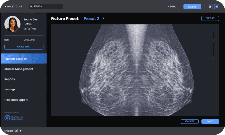 Mammography