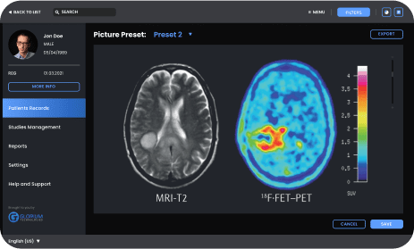 Neurology